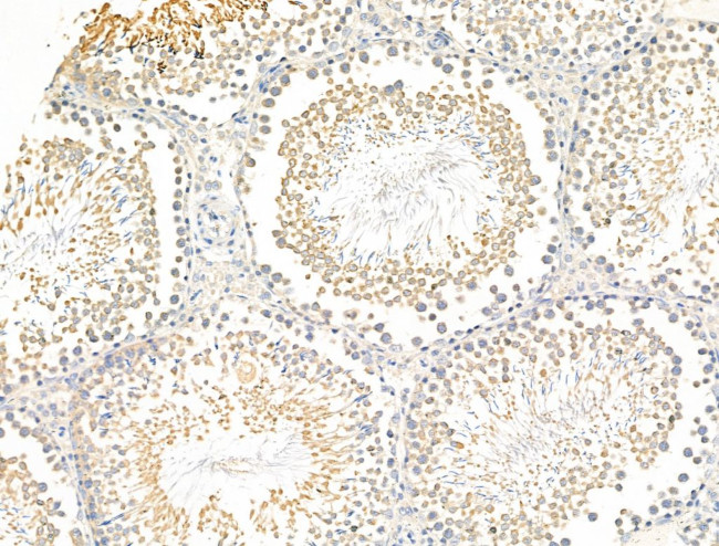 ZNF281 Antibody in Immunohistochemistry (Paraffin) (IHC (P))