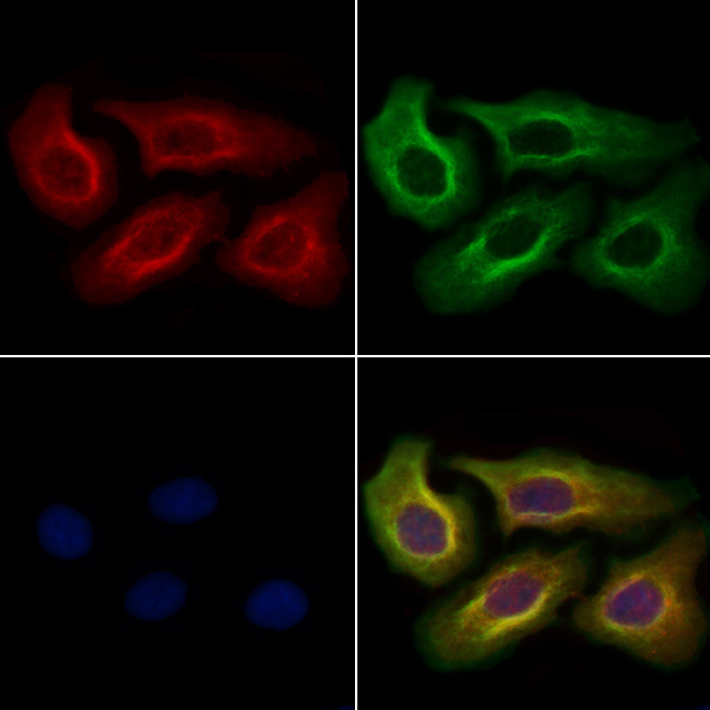 ZW10 Antibody in Immunocytochemistry (ICC/IF)