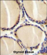 CGRP Antibody in Immunohistochemistry (Paraffin) (IHC (P))