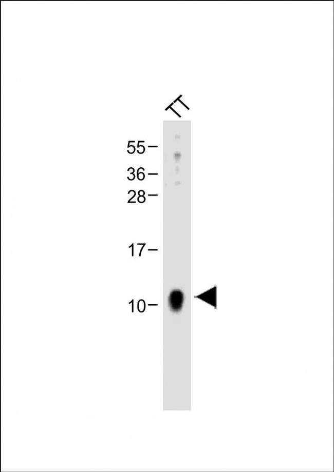 CGRP Antibody in Western Blot (WB)