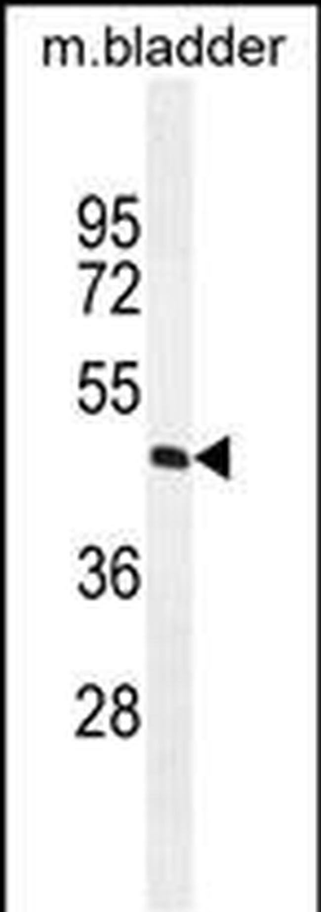 PPAPDC1A Antibody in Western Blot (WB)