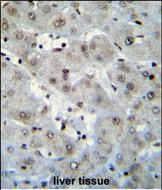 Histone H2A.Z Antibody in Immunohistochemistry (Paraffin) (IHC (P))