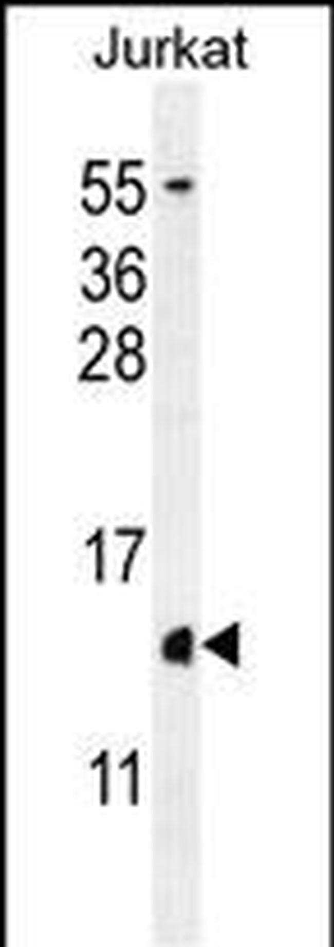 Histone H2A.Z Antibody in Western Blot (WB)