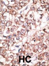 DKK2 Antibody in Immunohistochemistry (Paraffin) (IHC (P))