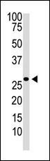 DKK2 Antibody in Western Blot (WB)