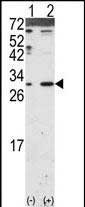 DKK2 Antibody in Western Blot (WB)