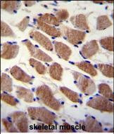 SAMD7 Antibody in Immunohistochemistry (Paraffin) (IHC (P))