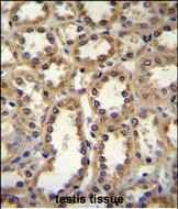 Glypican 6 Antibody in Immunohistochemistry (Paraffin) (IHC (P))