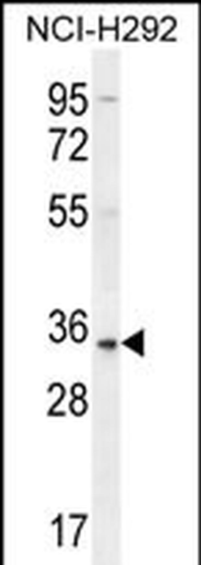 SFTPA2 Antibody in Western Blot (WB)