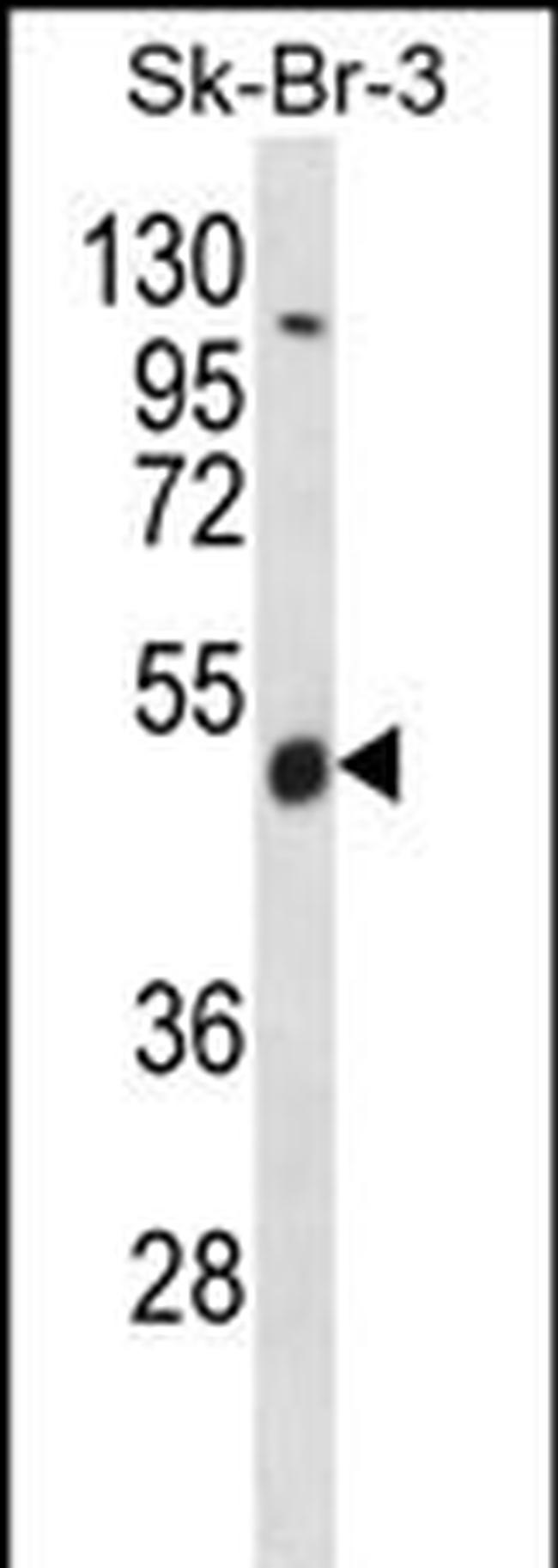 WDR34 Antibody in Western Blot (WB)