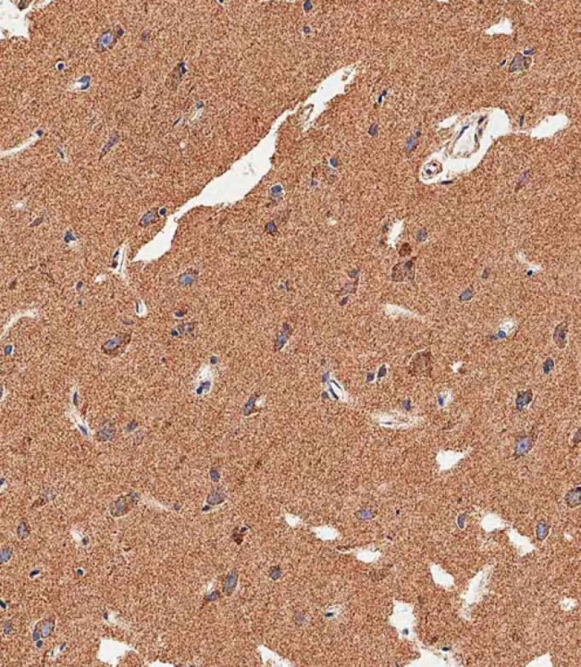 LC3B Antibody in Immunohistochemistry (Paraffin) (IHC (P))