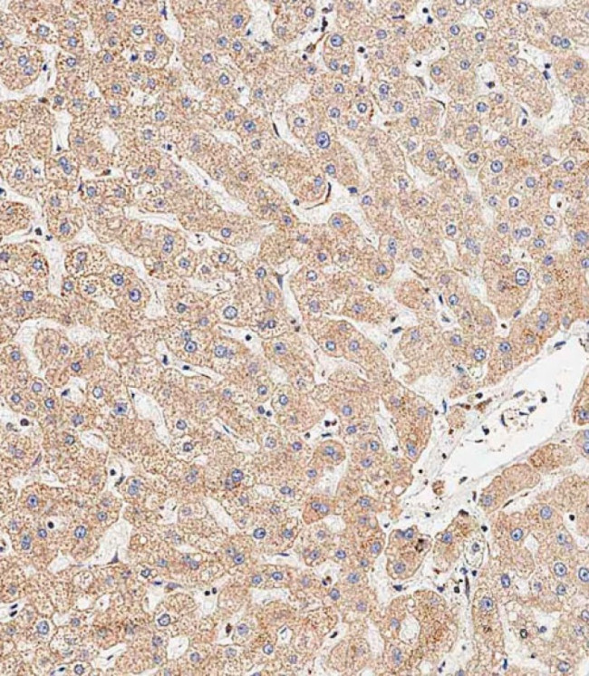 LC3B Antibody in Immunohistochemistry (Paraffin) (IHC (P))