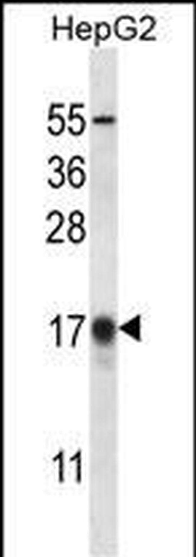 LC3B Antibody in Western Blot (WB)