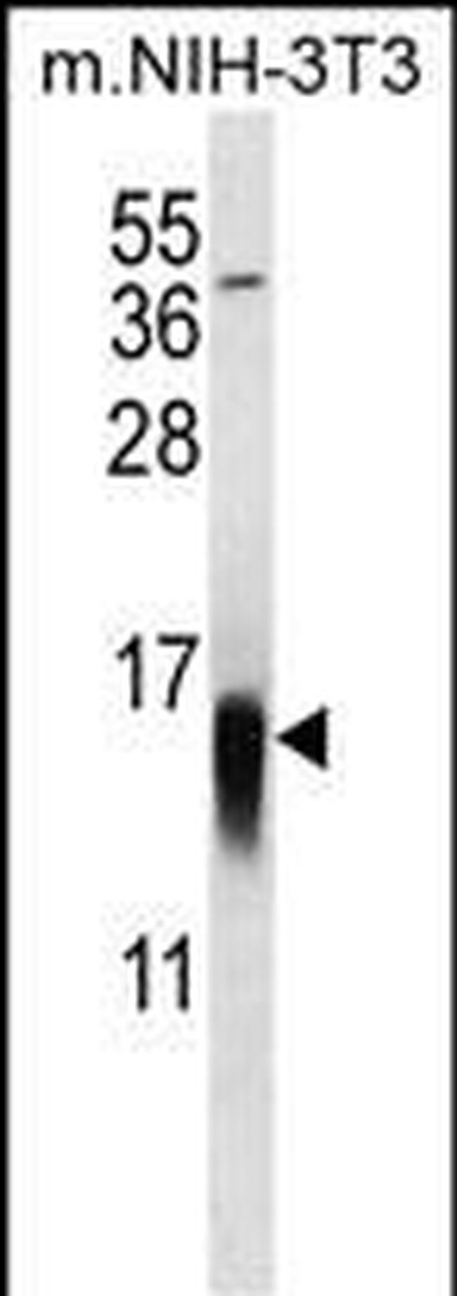 LC3B Antibody in Western Blot (WB)