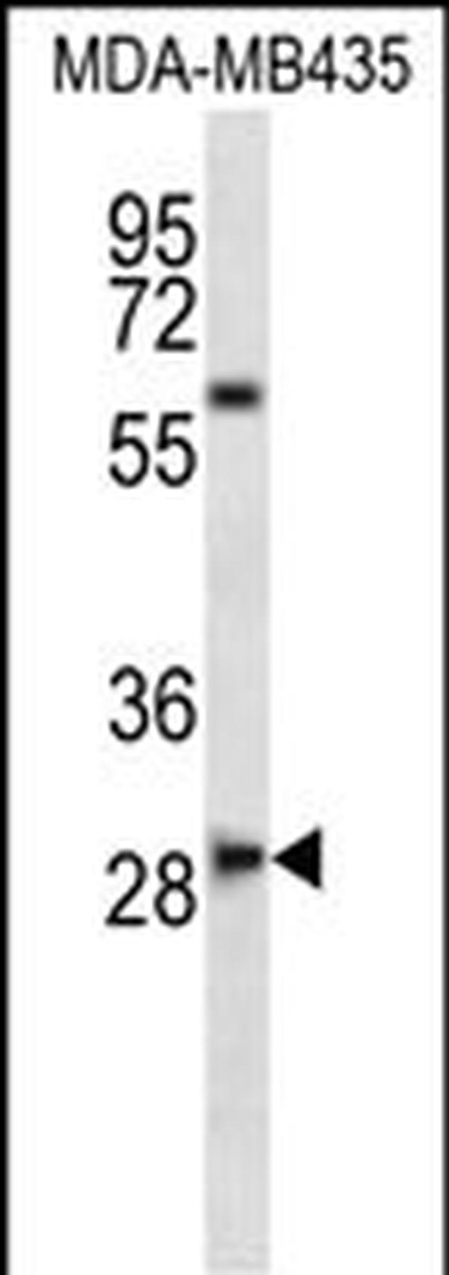 SLAMF8 Antibody in Western Blot (WB)