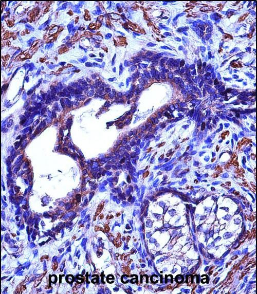 ACTG2 Antibody in Immunohistochemistry (Paraffin) (IHC (P))