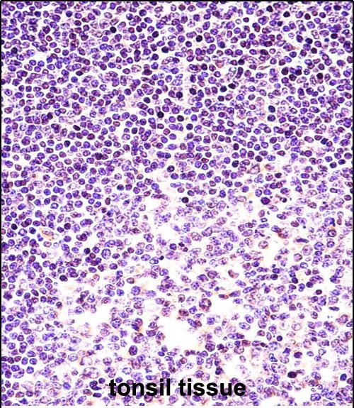 Histone H2A.X Antibody in Immunohistochemistry (Paraffin) (IHC (P))