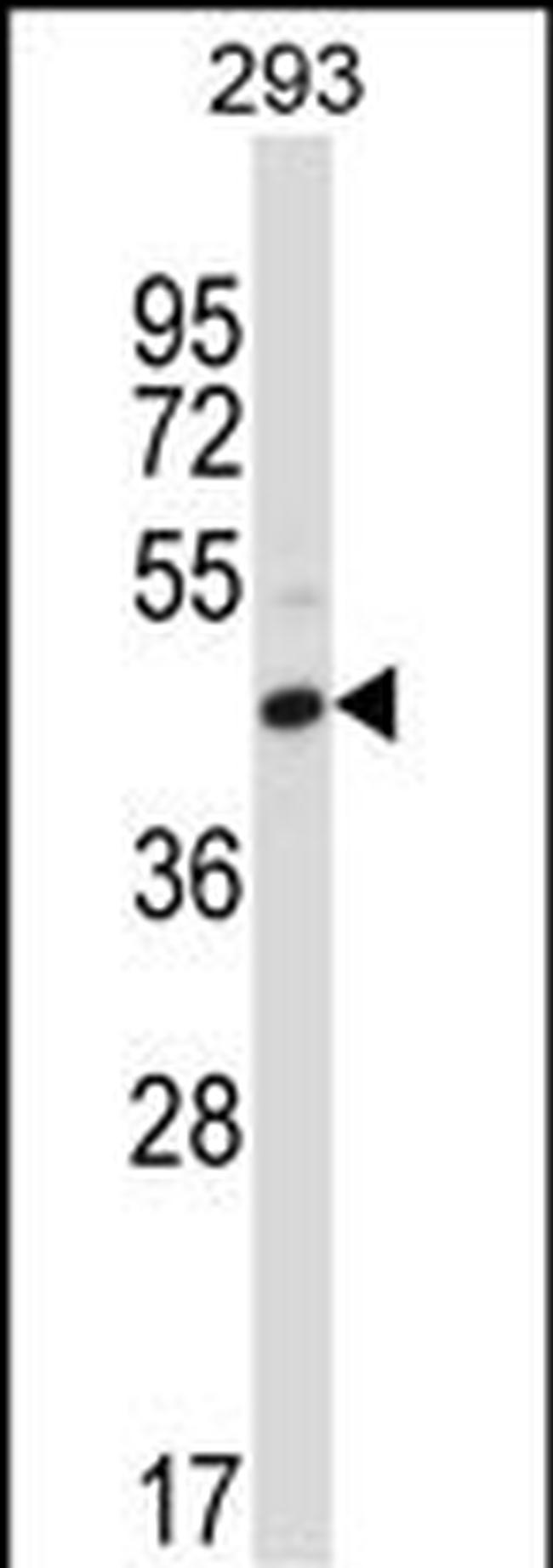 CD32 Antibody in Western Blot (WB)