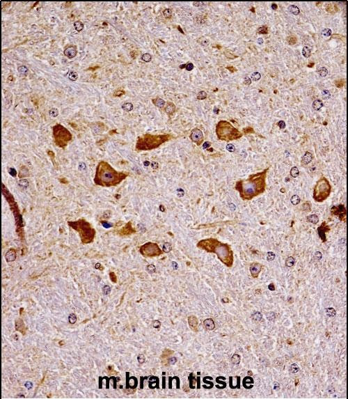 PAK7 Antibody in Immunohistochemistry (Paraffin) (IHC (P))