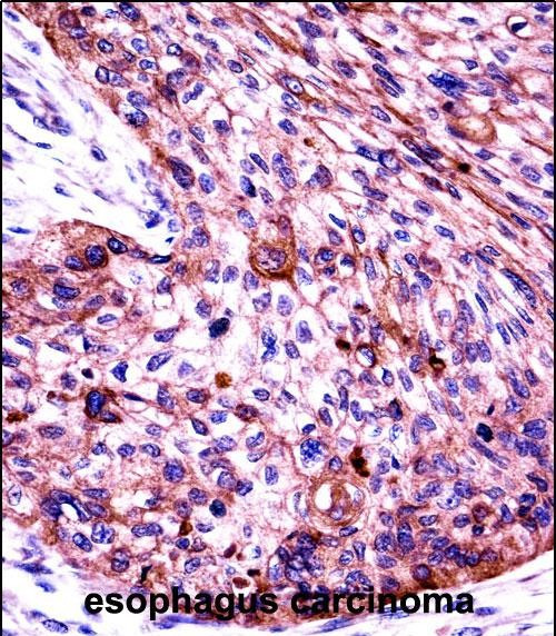 Cytokeratin 6 Antibody in Immunohistochemistry (Paraffin) (IHC (P))