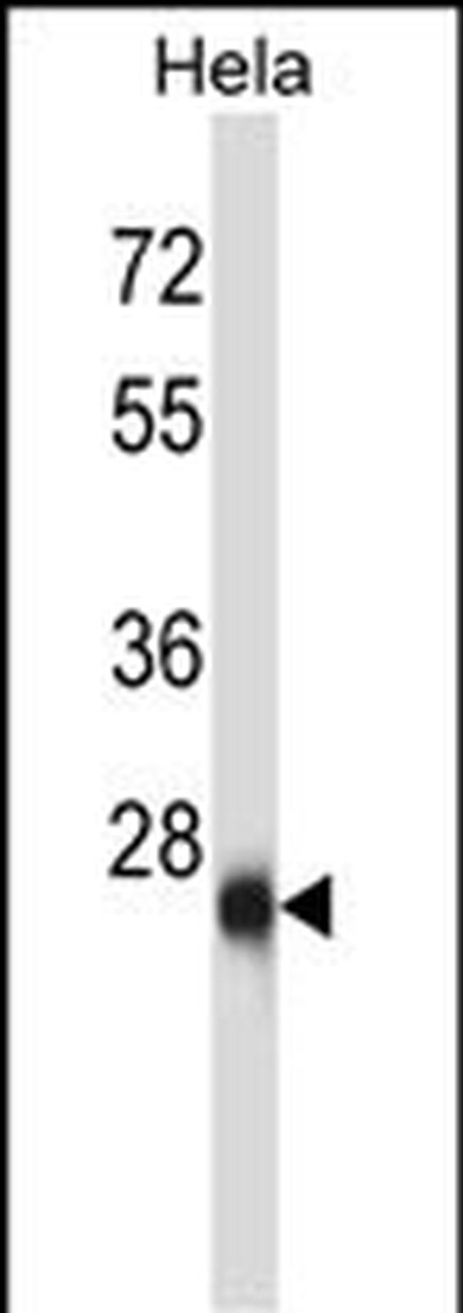 ZIC4 Antibody in Western Blot (WB)