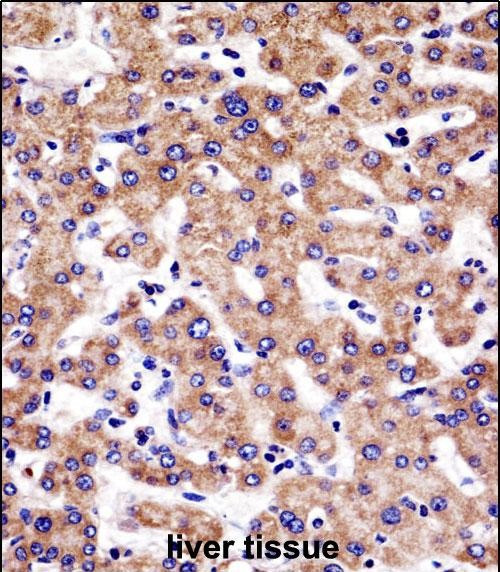 SULT1A3 Antibody in Immunohistochemistry (Paraffin) (IHC (P))