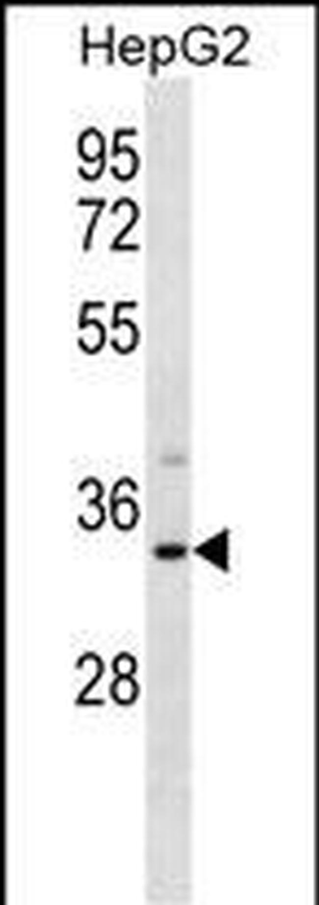 SULT1A3 Antibody in Western Blot (WB)