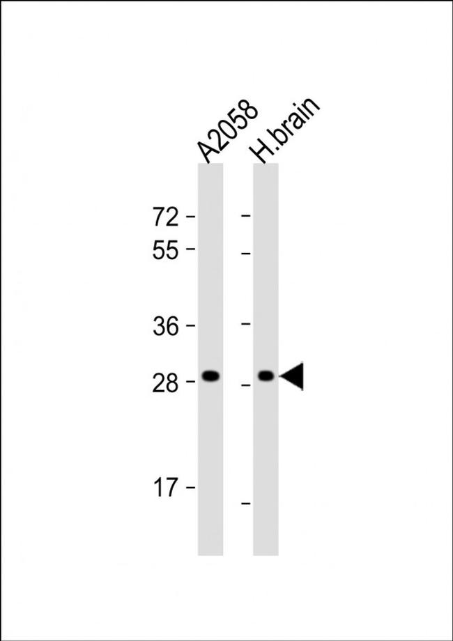 OR4F17 Antibody in Western Blot (WB)