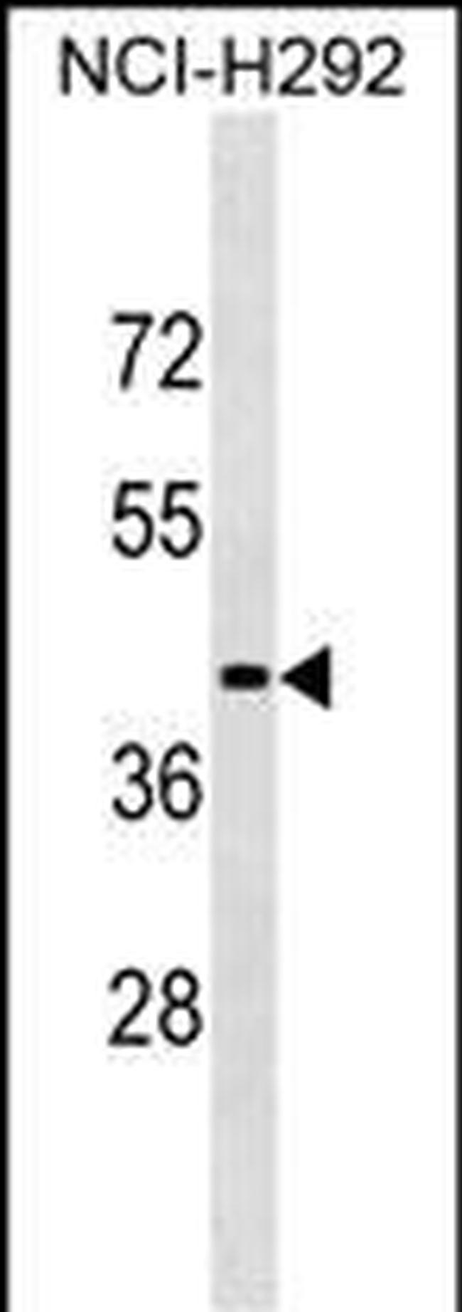 LIPN Antibody in Western Blot (WB)