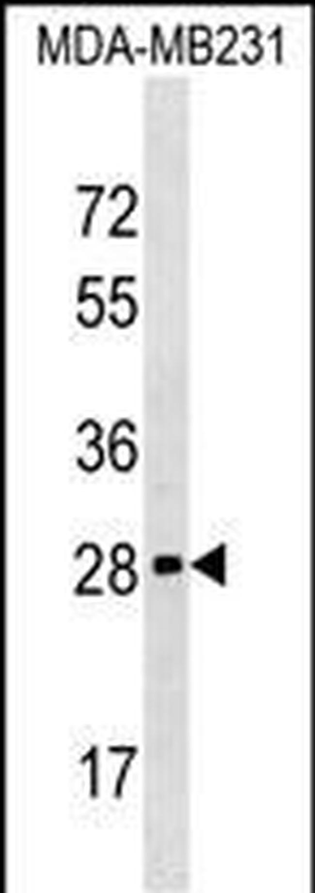 H1FOO Antibody in Western Blot (WB)