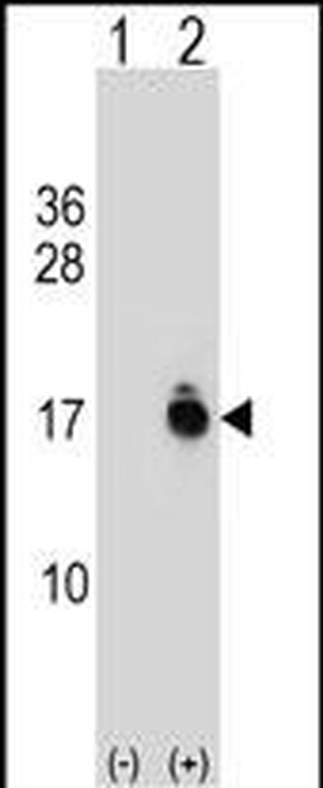 ACYP1 Antibody in Western Blot (WB)