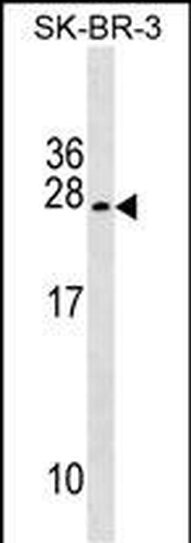 TUSC5 Antibody in Western Blot (WB)