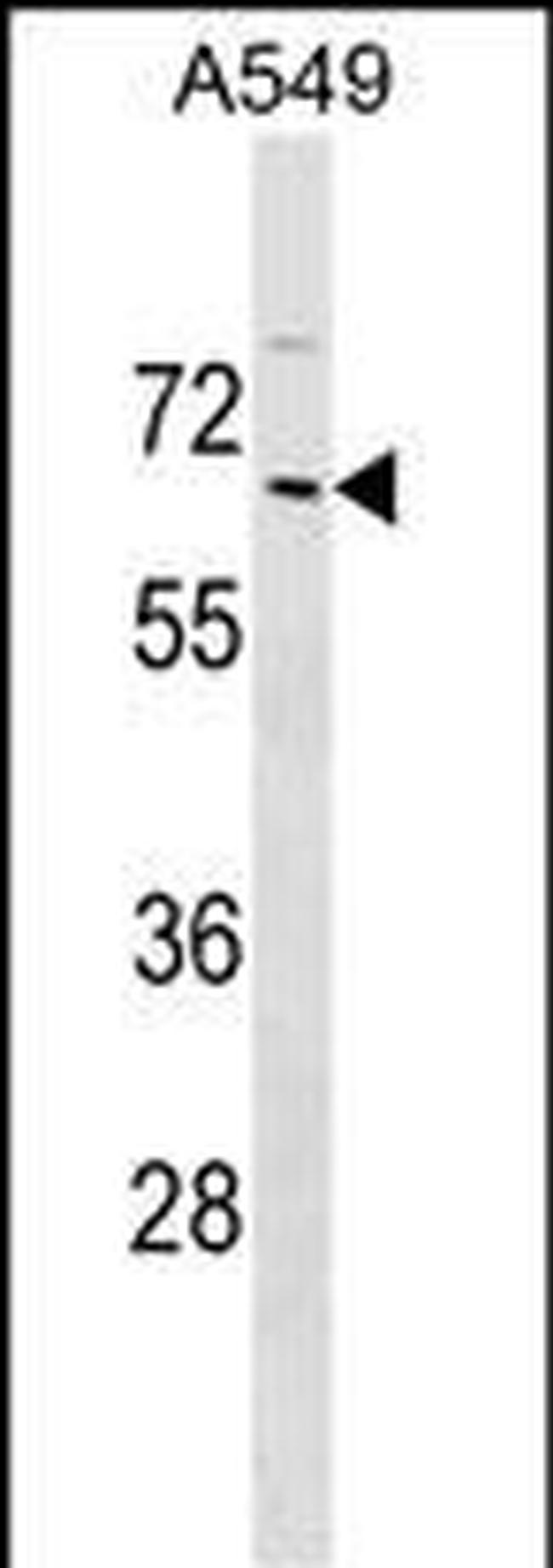 ZNF675 Antibody in Western Blot (WB)