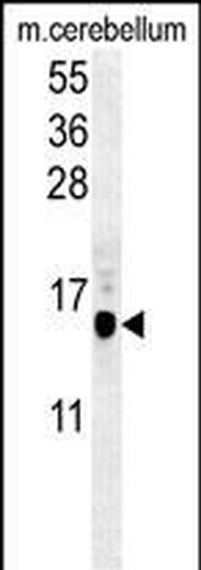 LC3B Antibody in Western Blot (WB)