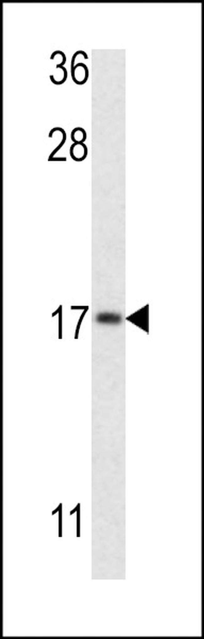 LC3B Antibody in Western Blot (WB)