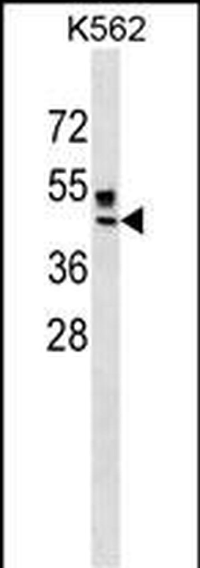 ZNRF4 Antibody in Western Blot (WB)