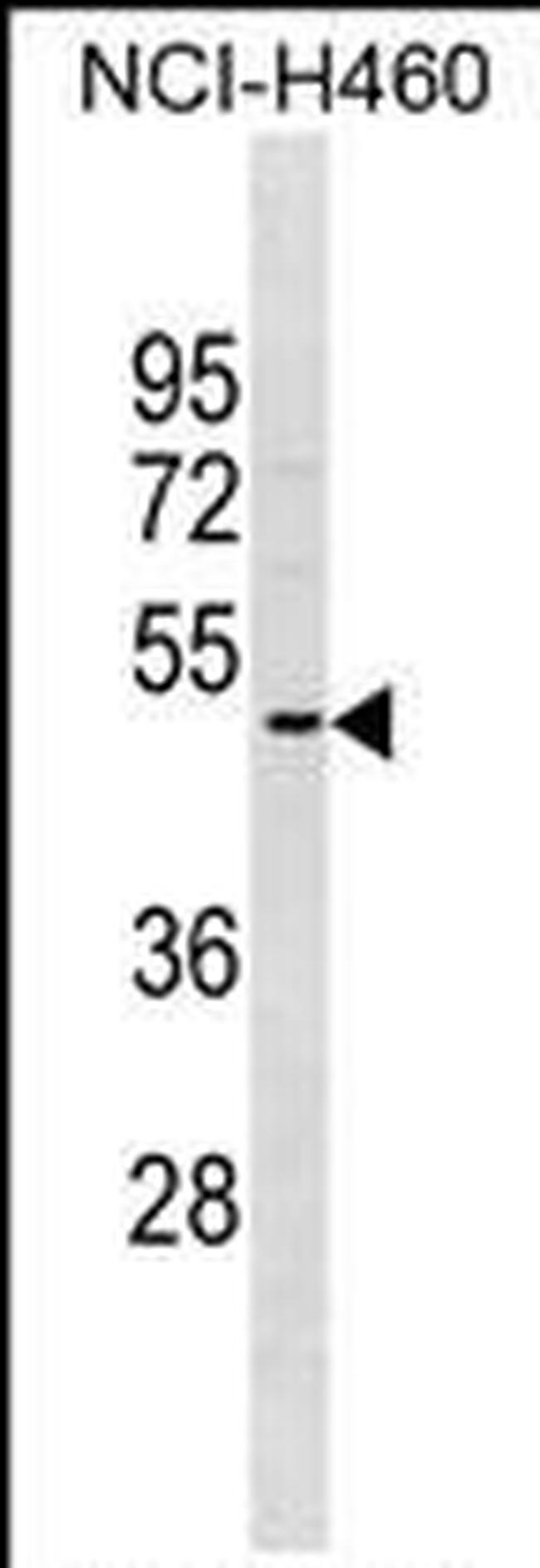 OR2A5 Antibody in Western Blot (WB)