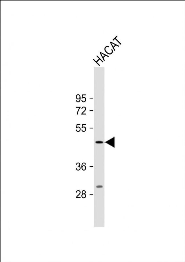 PGRP-1b Antibody in Western Blot (WB)