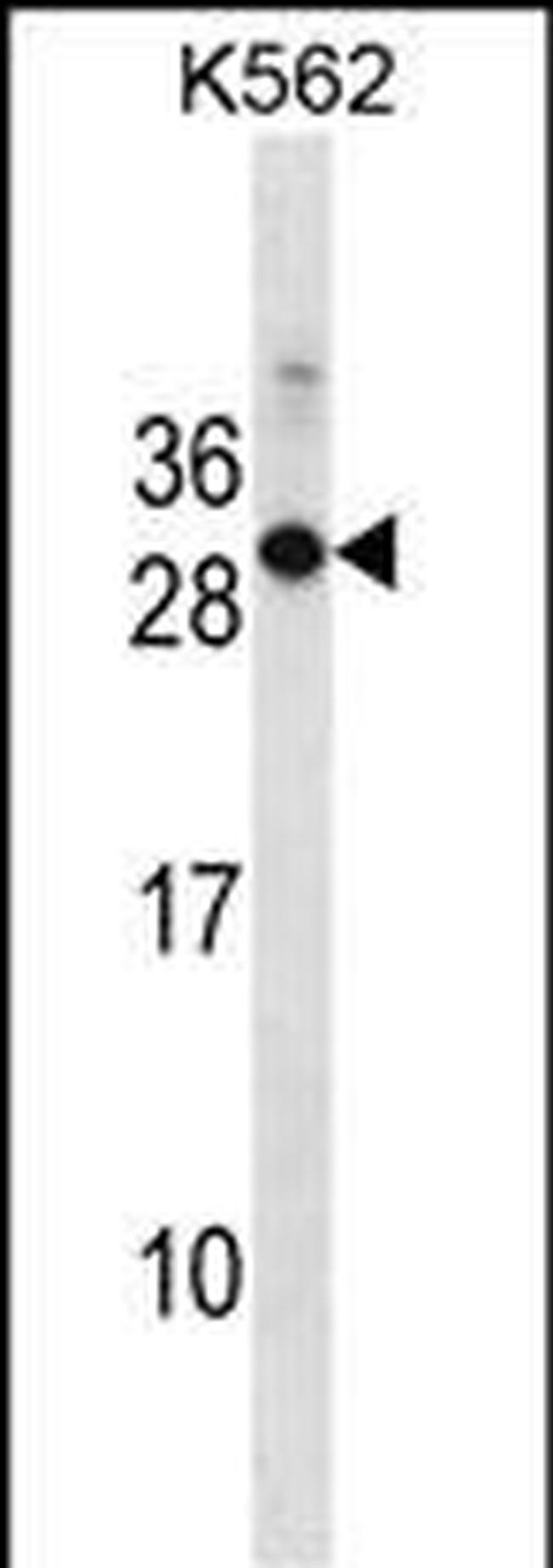 RAB17 Antibody in Western Blot (WB)