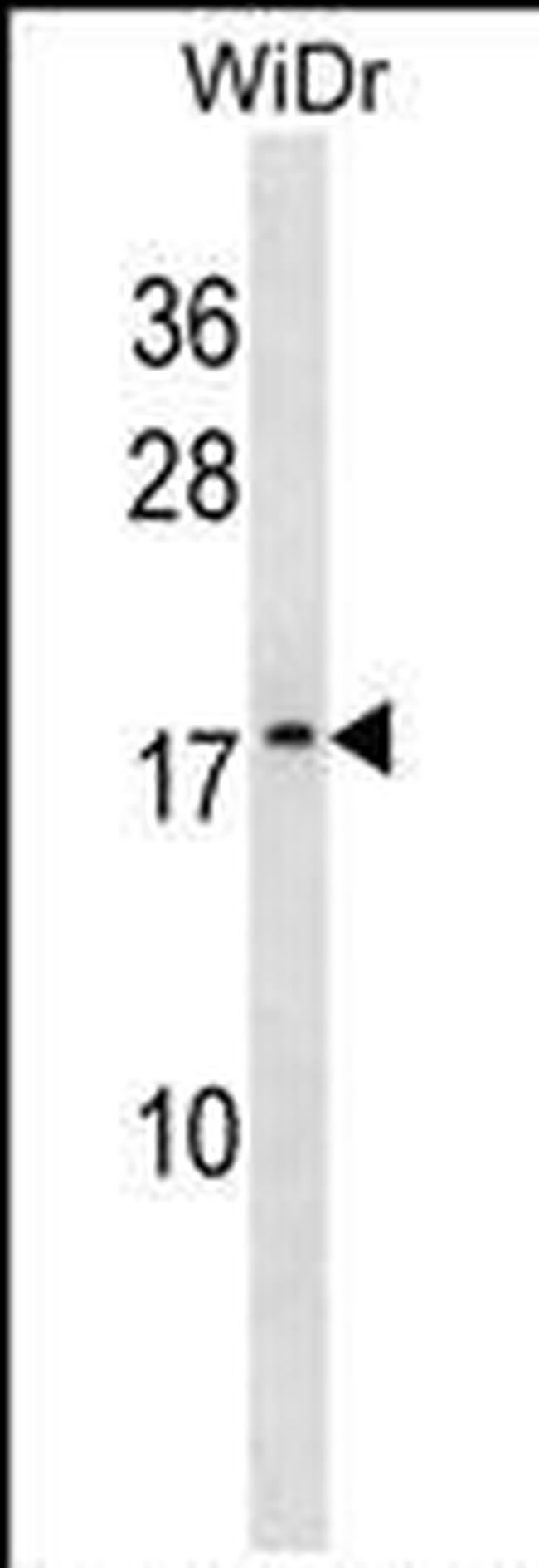 ATP5L2 Antibody in Western Blot (WB)