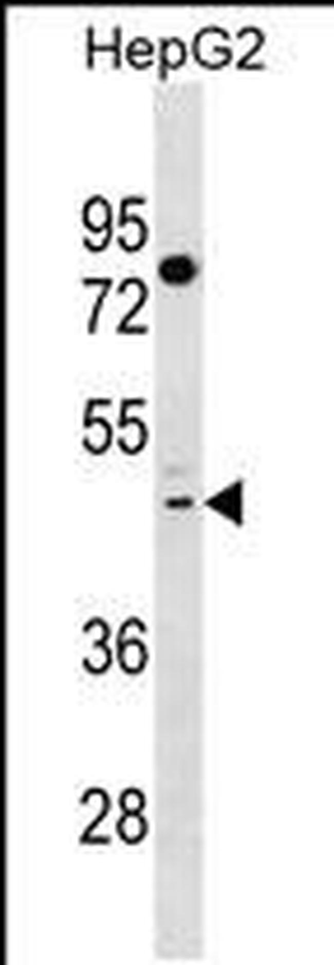 TAS2R41 Antibody in Western Blot (WB)