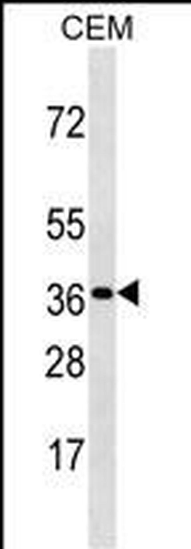 OR3A3 Antibody in Western Blot (WB)