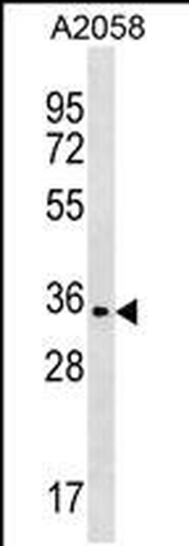 OR2T35 Antibody in Western Blot (WB)