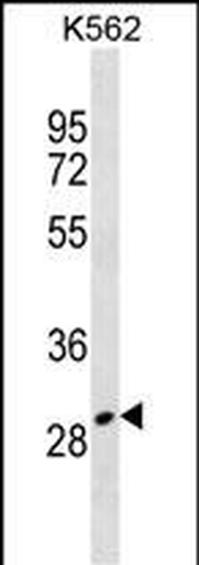 Talanin Antibody in Western Blot (WB)