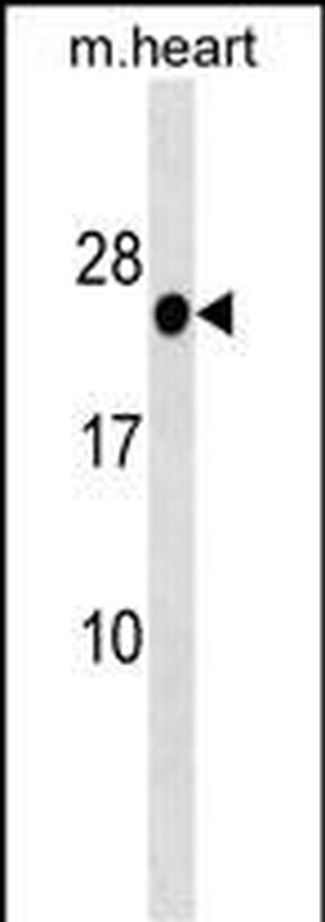 HOXB7 Antibody in Western Blot (WB)