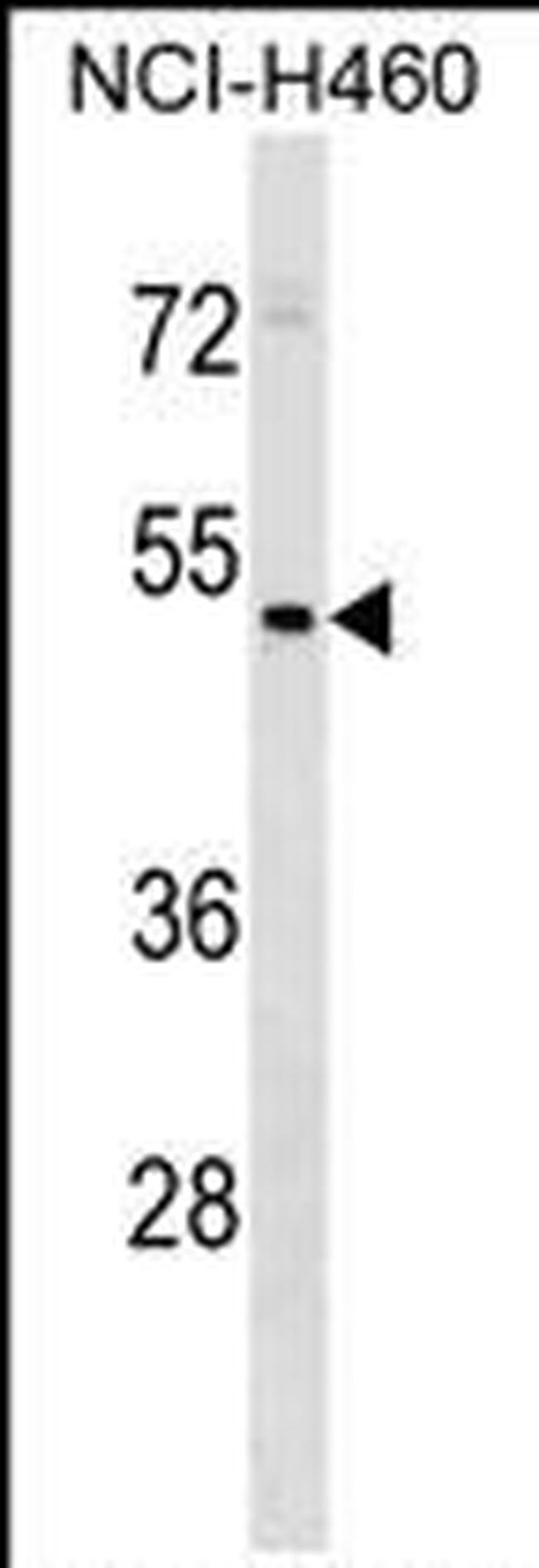 HEPACAM2 Antibody in Western Blot (WB)