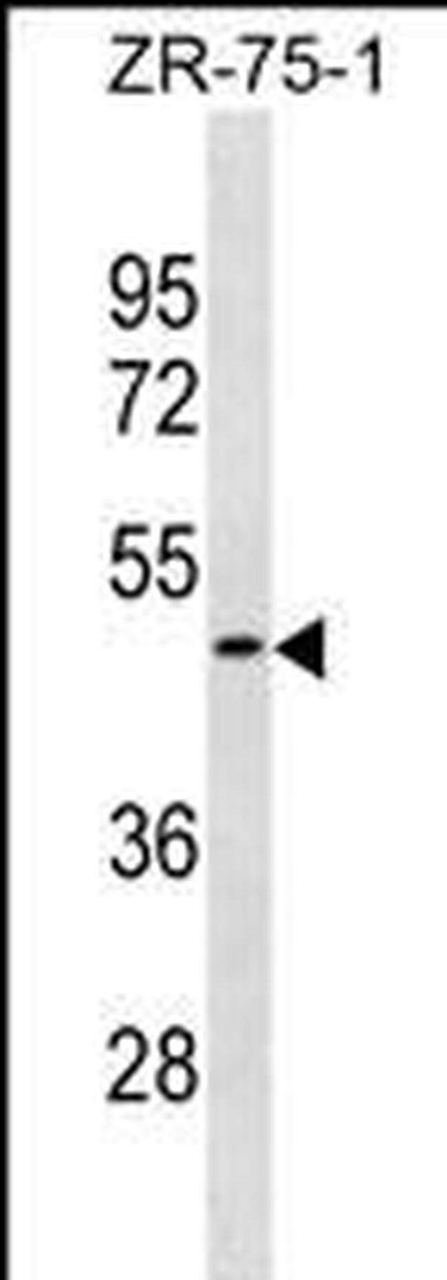 OR1S2 Antibody in Western Blot (WB)