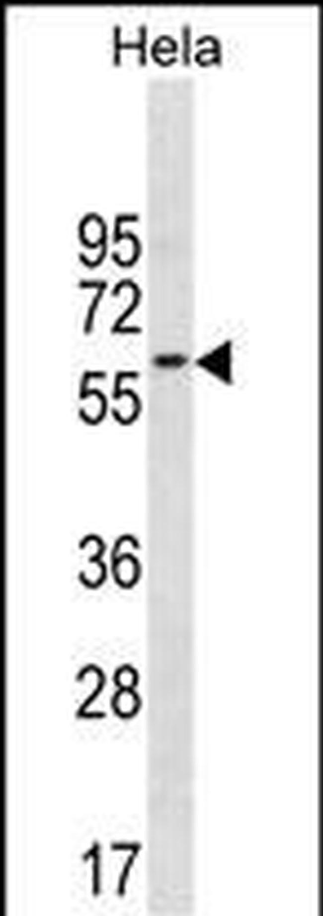 PAF49 Antibody in Western Blot (WB)