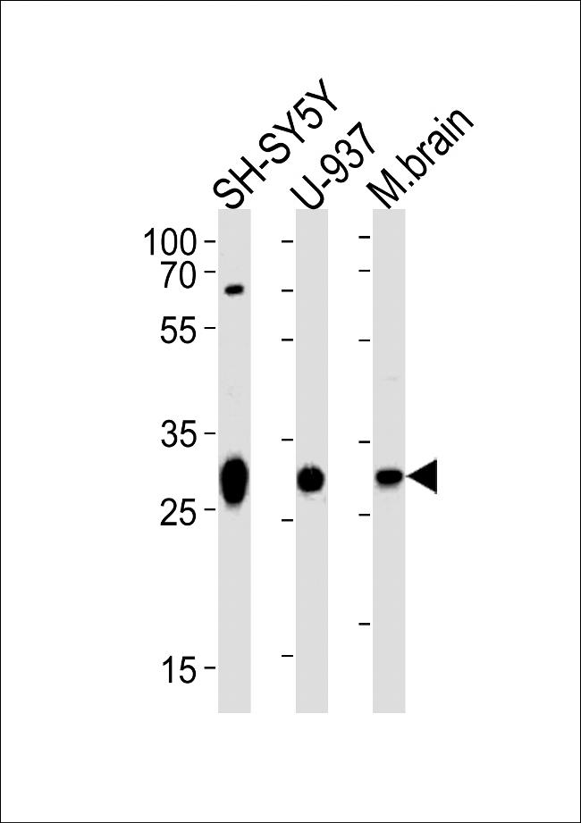 ANP32E Antibody in Western Blot (WB)