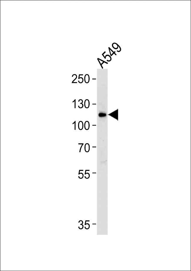 BICC1 Antibody in Western Blot (WB)